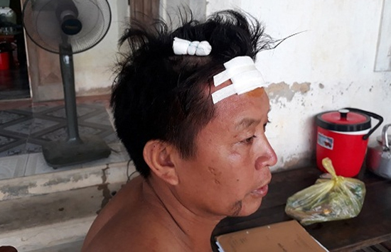 Hà Tĩnh: Truy bắt đối tượng trộm chó, tấn công chủ nhà trọng thương